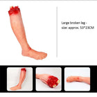 Large broken leg